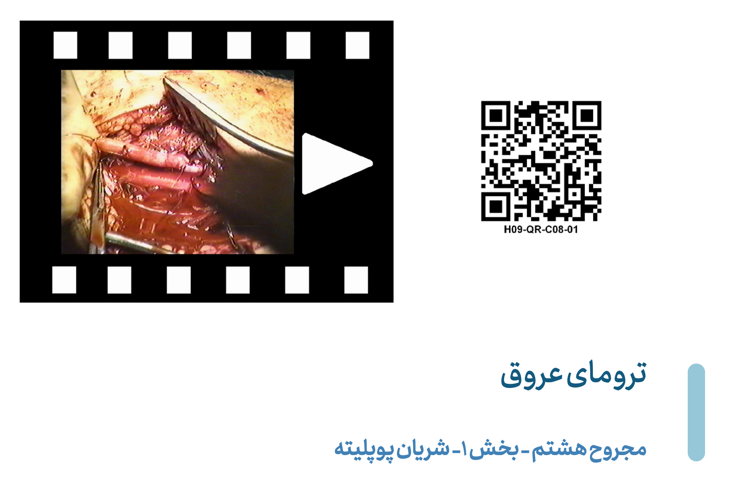 Popliteal-V08-P1