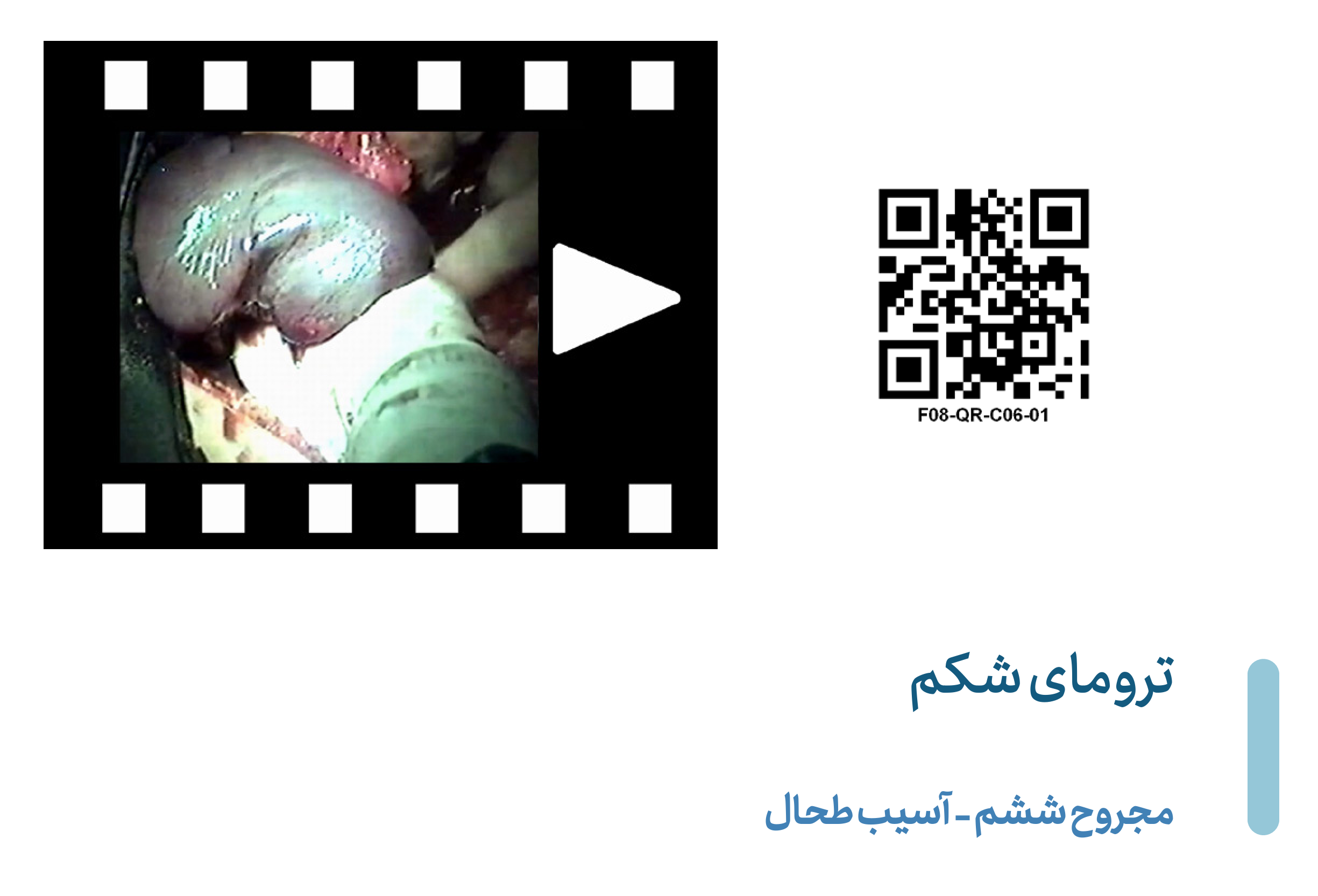 Splenic